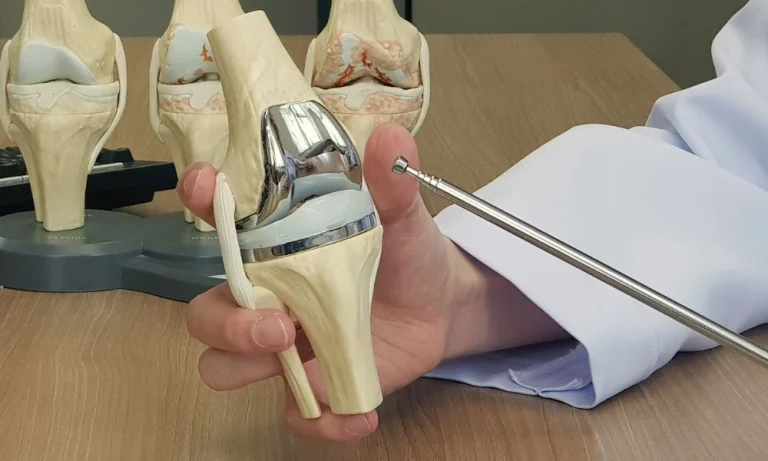 A doctor using a pointer to explain a total knee replacement implant model to a patient, demonstrating the patient education process at Dr. Gadekar's clinic.
