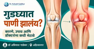 एका गुडघ्यात पाणी होऊन सूज आलेली आणि दुसरा सामान्य गुडघा दर्शवणारे चित्र